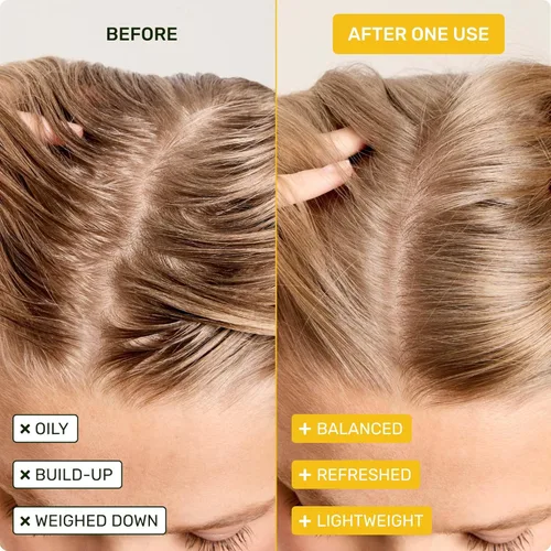 Miniatura 2 de Ethique Beauty Clarifying - Juego de champú y acondicionador para cabello graso y acumulación con aceite de ricino, sin plástico, vegano, sin