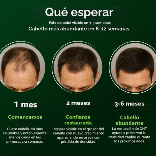Miniatura 6 de AlphaInfuse™ Suero nutritivo para el cuero cabelludo para hombres – Mezcla botánica de ginseng y Eclipta para un cabello de aspecto más completo