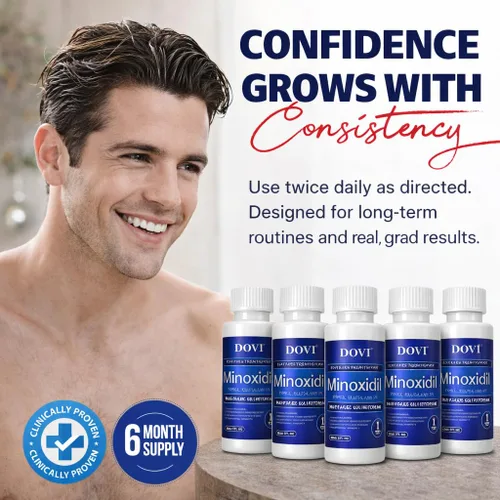 Miniatura 6 de Dovi Minoxidil - Tratamiento para el crecimiento del cabello al 5% para hombres, solución tópica avanzada extra fuerte, suministro de 6 meses, ayuda