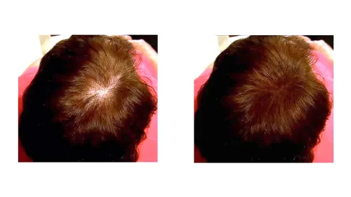 Miniatura 5 de Caboki Fibras capilares para adelgazar el cabello con aplicador de fibra capilar incorporado, fibra capilar a base de plantas para hombres