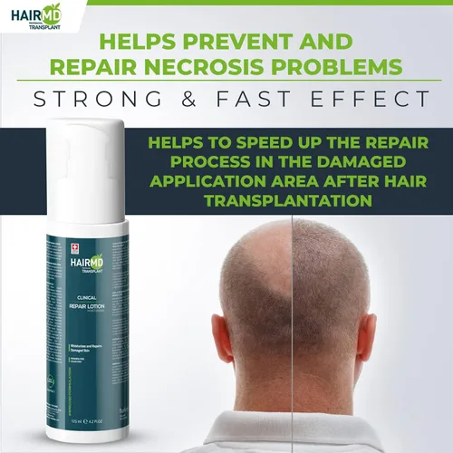 Miniatura 2 de HairMD Loción de reparación clínica de trasplante – 4.2 fl oz fórmula post-trasplante capilar – suave, nutritiva e hidratante en cuero cabelludo