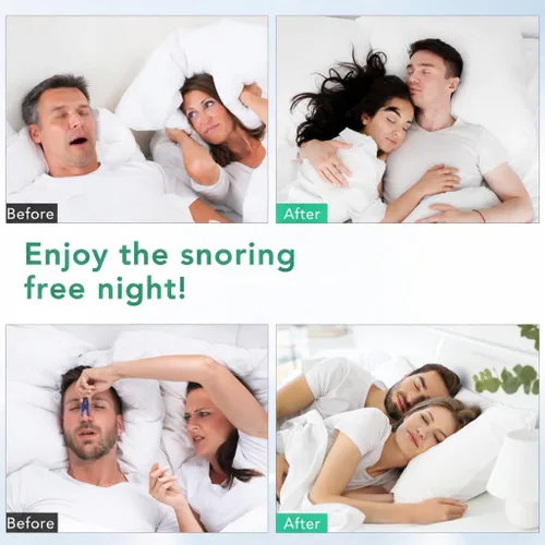 Miniatura 5 de CINWAUVO Anti ronquidos de ventilación nasal 8 conos nasales dilatador nasal para detener ronquidos eficaz ronquido dispositivos anti ronquidos