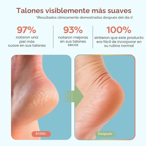 Miniatura 3 de ZenToes Calcetines de talón hidratante, 2 pares de calcetines de spa con forro de gel para curar y tratar talones secos y agrietados mientras Azul