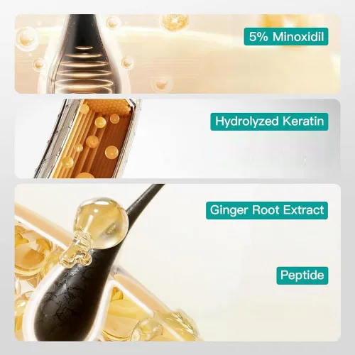 Miniatura 5 de Crema de masaje para el cuero cabelludo de minoxidil al 5%, minoxidil para hombres y mujeres, suero de crecimiento del cabello, minoxidil