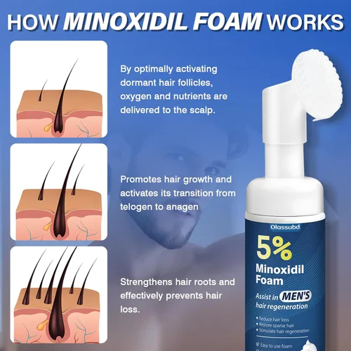 Miniatura 4 de Minoxidil 5% de espuma para el crecimiento del cabello para hombres, adecuada para adelgazamiento del cabello, línea capilar y pérdida de cabello a