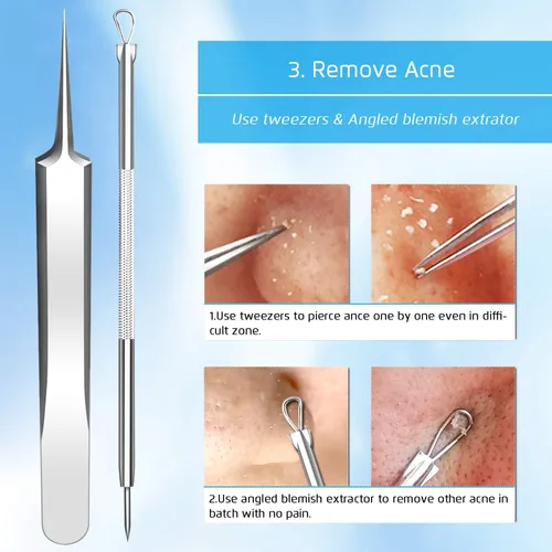 Miniatura 6 de Mejor removedor de puntos negros, eliminación de imperfecciones de puntos negros, kit de eliminación de puntos blancos de acné, herramienta