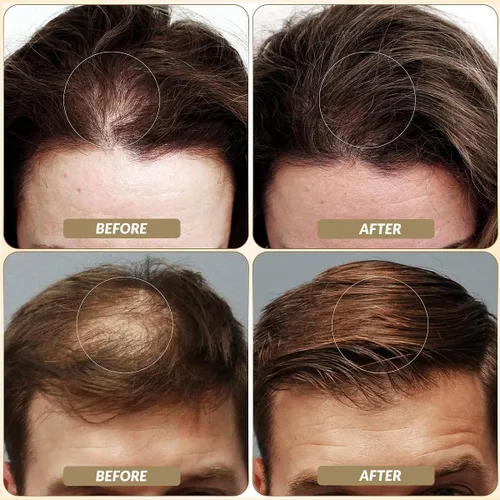 Miniatura 3 de SOVONCARE Fibras capilares blancas para adelgazar el cabello, fibras de construcción del cabello para puntos calvos, indetectables y naturales