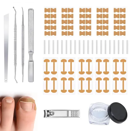 Kit corrector de uñas encarnadas, herramientas de uñas, tiras de corrección transpirables con herramientas de levantamiento de uñas, cortaúñas y
