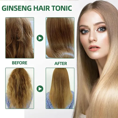 Miniatura 2 de Spray para el crecimiento del cabello, tonico para crecimiento del cabello, hierbas naturales, tónico para el cabello ginseng, más fuerte y 1