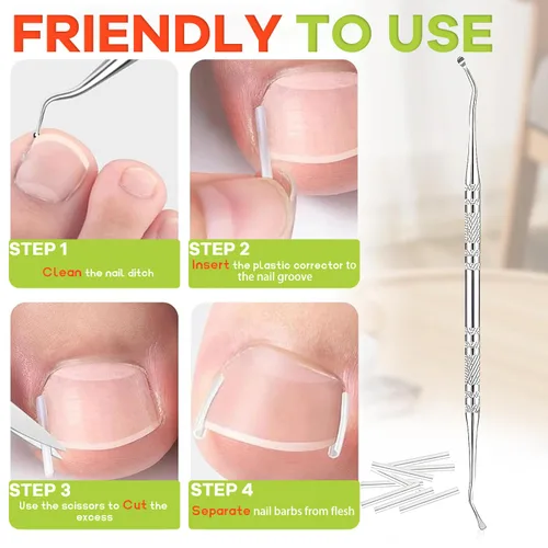 Miniatura 2 de Kit corrector de uñas encarnadas, herramientas de uñas, tiras de corrección transpirables con herramientas de levantamiento de uñas, cortaúñas