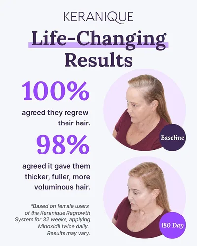 Miniatura 3 de Keranique Tratamiento para el crecimiento del cabello para mujeres, 2% de minoxidil para el crecimiento y engrosamiento del cabello, solución tópica