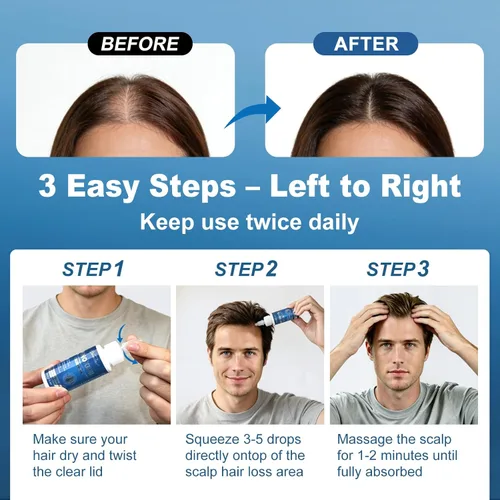 Miniatura 5 de Paquete de 8 sueros para el crecimiento del cabello y la barba de minoxidil al 5%, con biotina y aceite de ricino, minoxidil para hombres y mujeres