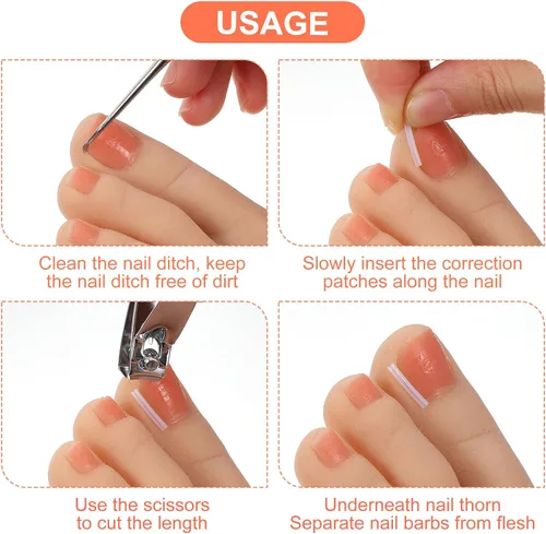 Miniatura 2 de (50+2) Juego de corrector de uñas encarnadas con cortaúñas, kit profesional de eliminación de uñas encarnadas sin dolor con levantador, tira de uñas