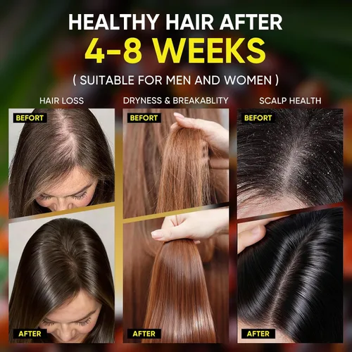 Miniatura 3 de Batana Oil Exfoliante para el crecimiento del cabello, batana orgánica para nutrir el cabello con romero, aceite de cuero cabelludo promueve
