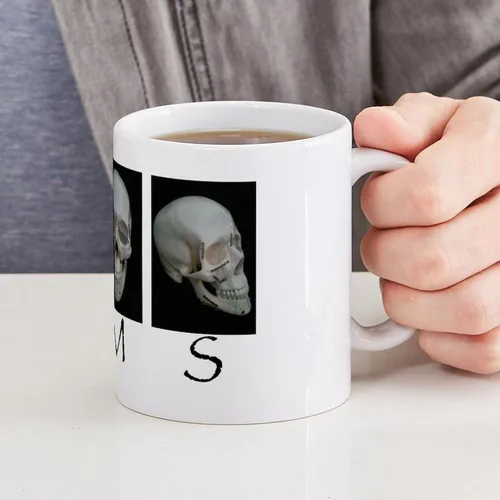Miniatura 6 de CafePress OMS - Taza quirúrgica con diseño de calavera de 11 oz (11.0 fl oz)