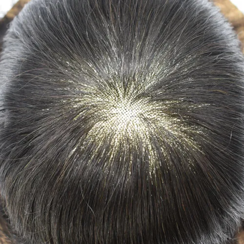 Miniatura 6 de LYRICAL HAIR Toupee - Sistema de cabello de repuesto para hombre, monofilamento para hombre, tupé fino, monofilamento, piel de polietileno
