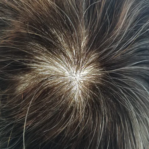 Miniatura 4 de Toupee Hombres Hairpiece Full Poly Toupee para hombres Cabello humano 77 colores PU inyección Mens Toupee sistema de reemplazo de cabello humano