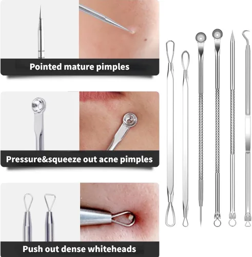 Miniatura 7 de Kit de herramientas para eliminar puntos negros, kit de 15 piezas, kit profesional de eliminación de acné de acero inoxidable para nariz y cara