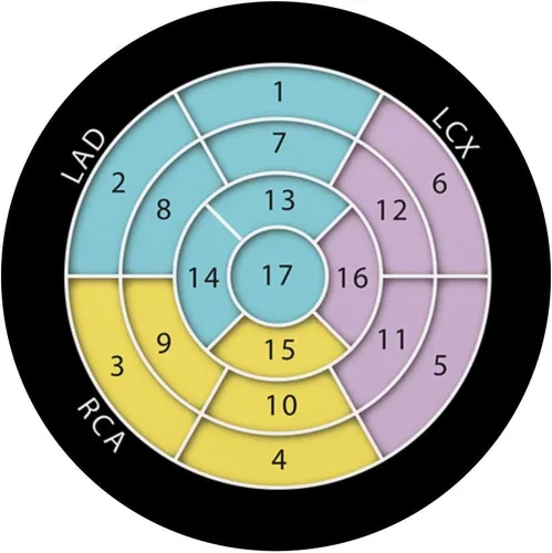 Miniatura 3 de Echocardiography Bulls eye 17 Segment Technician Gifts - PopSockets Grip and Stand for Phones and Tablets