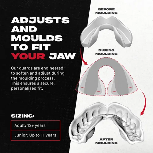 Miniatura 2 de SAFEJAWZ Protector bucal, triple capa para adultos con estuche, boquilla de fácil ajuste extraíble de alta calidad para fútbol, boxeo, lacrosse