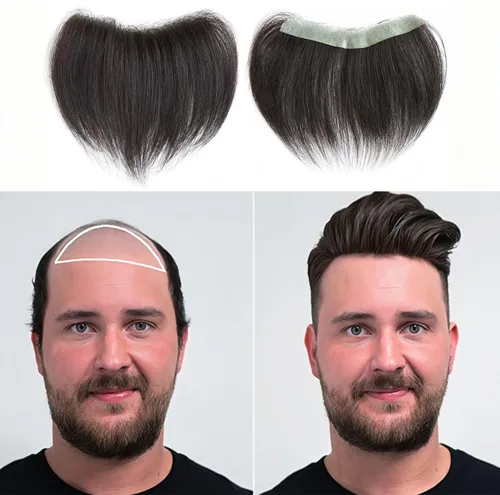 Miniatura 11 de Extensión frontal de cabello rubio claro para hombres, extensión de cabello lacio con pérdida de línea de cabello humano con cinta adhesiva