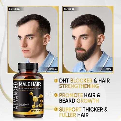 Miniatura 3 de Vitaminas para el crecimiento del cabello para hombres, anti pérdida de cabello, píldoras de vitaminas y bloqueador de Dht para hombres. Suplemento