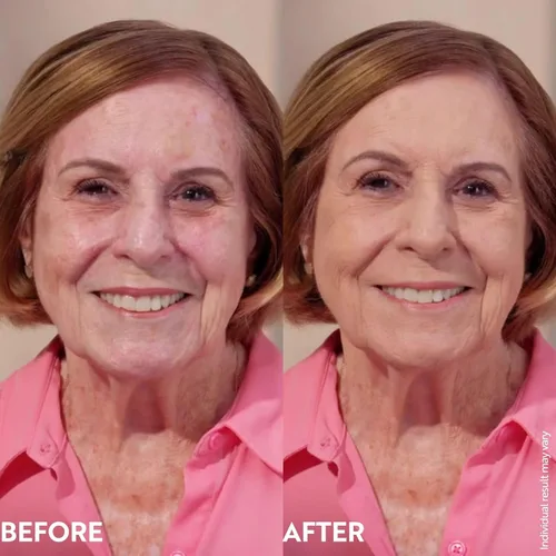 Miniatura 5 de Crema Ligera para rellenar arrugas – Reduce la apariencia de arrugas, enrojecimiento, de manchas e imperfecciones – Acabado mágico para brillos