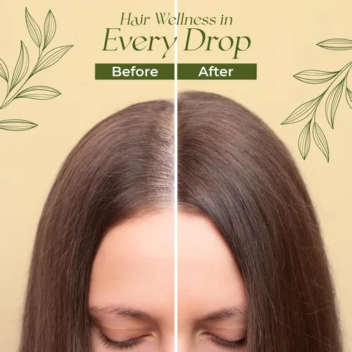 Miniatura 6 de Aceite natural para el crecimiento del cabello Veganic para mujeres infundido con 10 aceites botánicos premium más aceite de romero orgánico