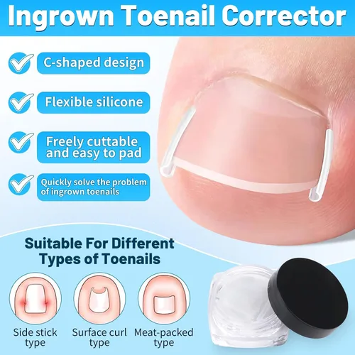 Miniatura 3 de SelfTek Kit de uñas encarnadas – Kit profesional de corrector de uñas encarnadas con tiras transpirables y parches curvos, lima sin dolor