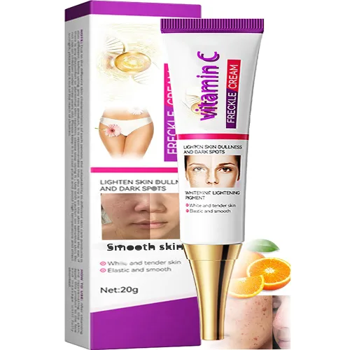 Removedor de manchas oscuras para rostro, crema de niacinamida Manchas Oscuras, 0.71 oz Crema Premium Manchas Edad, manchas oscuras en manos,