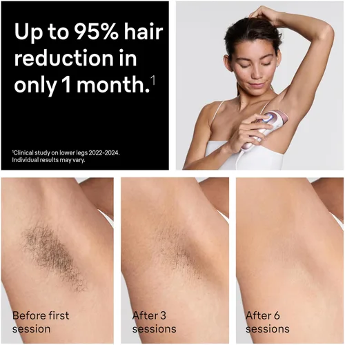 Miniatura 5 de Braun Smart IPL, Skin i·Expert Pro 7, el mejor dispositivo de depilación de VOGUE, depilación IPL para mujeres y hombres, reducción permanente