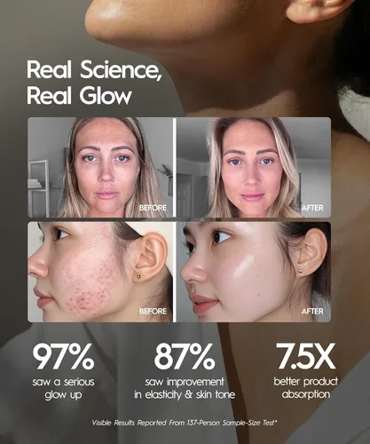 Miniatura 4 de REVO Genie Masajeador facial para cara y cuello, dispositivo de belleza LED con calor y vibración, herramienta de escultura con modos de luz roja