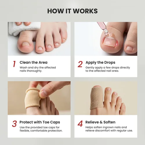 Miniatura 5 de Treatonic Gotas de tratamiento de uñas encarnadas, kit de suavizante y alivio de uñas encarnadas para un fácil recorte con tapas de gel de silicona