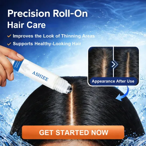 Miniatura 2 de Roll-On para el crecimiento del cabello con romero y jengibre, suero de crecimiento del cabello enrollable de precisión para adelgazar el cabello