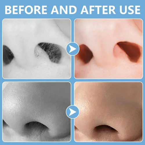 Miniatura 7 de Cortador de pelo nasal 2 en 1, recortador manual de doble cara con cepillo, cuchillo de nariz giratorio de 360° para hombres y mujeres, herramienta