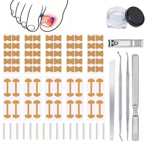Juego de corrector de uñas encarnadas con tiras de corrección,Kit de herramientas profesional de uñas encarnadas,Parche corrector de uñas