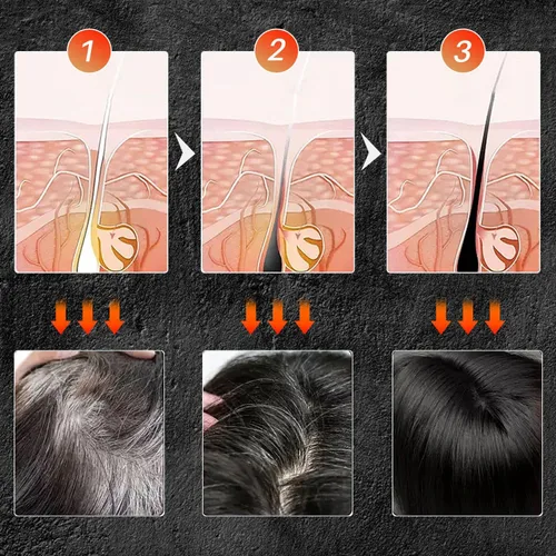 Miniatura 4 de TPTAL Barra inversa de cabello gris, jabón negro para cobertura de cabello gris, barra de champú para oscurecer el cabello natural, champú