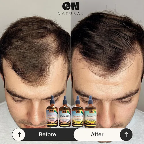 Miniatura 9 de On Natural Aceite de batana para mejorar el cabello y el cuero cabelludo