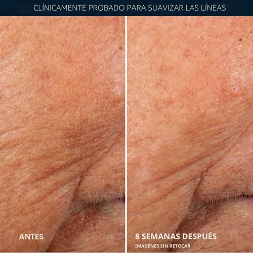 Miniatura 6 de RoC Retinol Correxion Suero de Noche Anti-Envejecimiento contra Arrugas, Suero de Retinol para el Rostro, Tratamiento Diario para Líneas Finas