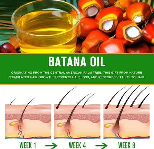 Miniatura 3 de Paquete de 3 aceites de batana para el crecimiento del cabello, puro y natural para cabello dañado, hidratación y reparación de cuidado de la piel