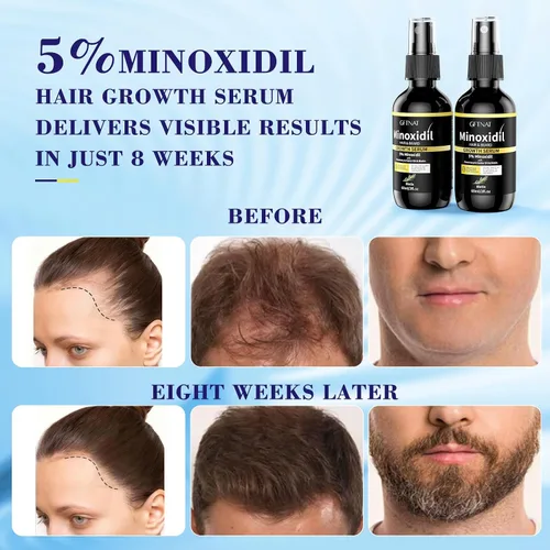 Miniatura 4 de Spray de minoxidil al 5% para hombres y mujeres, solución para la pérdida de cabello con biotina y suero de crecimiento del cabello de romero