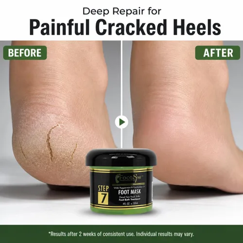 Miniatura 6 de FOOT SPA - Máscara de crema para pies, 4 onzas con aceite de menta y eucalipto, masaje de pedicura para pies y cuerpo cansados, hidratante, piel