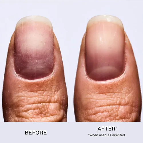 Miniatura 4 de OPI Nail Envy, 0.5 onzas líquidas y fortalecedor de uñas natural OPI