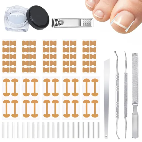 Juego de corrector de uñas encarnadas con tiras correctoras, kit de eliminación de uñas encarnadas, parche corrector, herramientas de pedicura,