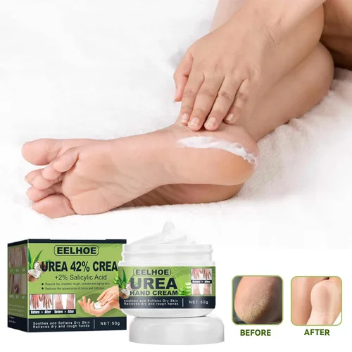 Miniatura 8 de Crema reparadora de pies de manteca de karité, ungüento curativo de la piel para talones agrietados y pies secos Crema exfoliante para masaje de 1