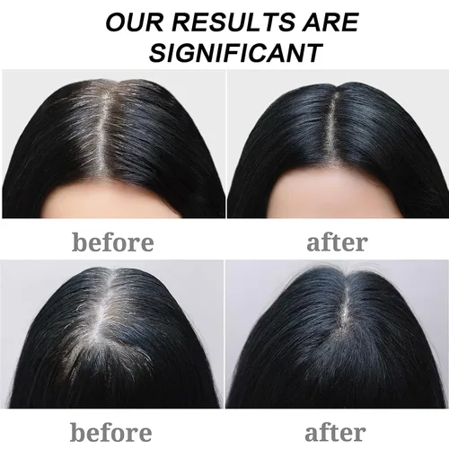 Miniatura 5 de Barra de champú reversible para cabello gris, 2 unidades de jabón para oscurecer el cabello gris para limpiar profundamente el cuero cabelludo