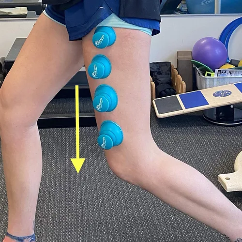 Miniatura 5 de Riptide" Sport Cupping juego de 4 copas de empuje en estuche de Wavetools Therapy ideal para ventosas dinámicas, dos ventosas fuertes