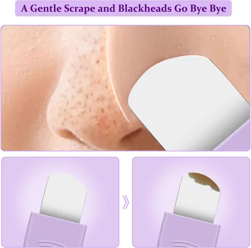 Miniatura 2 de Herramienta removedor de puntos negros, limpiador facial de silicona, raspador de poros de nariz 2 en 1 para limpieza profunda, espátula de piel