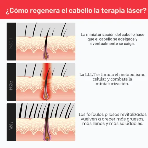 Miniatura 8 de iRestore Sistema de crecimiento del cabello con láser esencial: tratamientos de pérdida de cabello aprobados por la FDA para hombres y mujeres