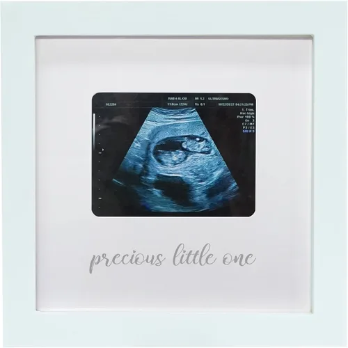 Miniatura 14 de Sonogram - Marco de fotos para abuela, marco de fotos de ultrasonido, anuncio de embarazo para abuela, ideas de anuncio de bebé, marco de fotos
